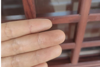 快速有效解决铝合金窗花灰尘堆积问题【冠墅阳光】